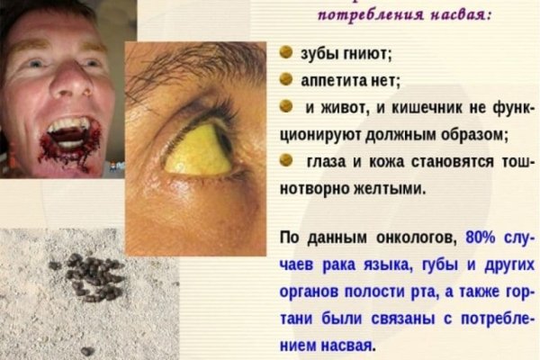 Кракен даркент